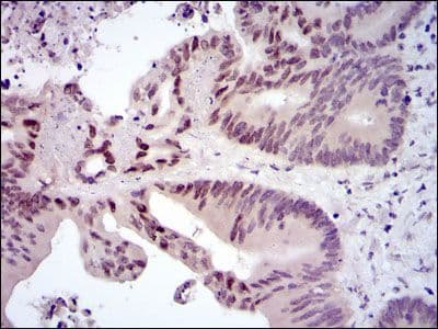 FOS / c-FOS Antibody (clone 2G2)