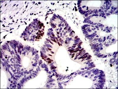 Monoclonal Mouse anti-Human MSH6 Antibody (clone 30, IHC, IF, WB)