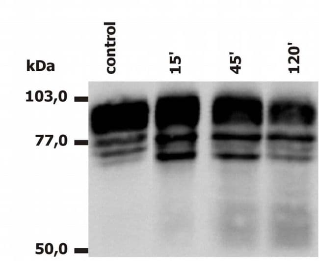ITGB2 / CD18 Antibody (clone MEM-148)