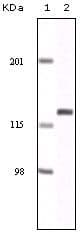 EPHA2 / EPH Receptor A2 Antibody (clone 1B3C7)