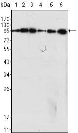 Monoclonal Mouse anti-Human DNM1 / Dynamin Antibody (clone 3G4B6, IHC, WB)