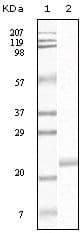 EPHB4 / EPH Receptor B4 Antibody (clone 5B8F7)