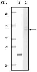 Monoclonal Mouse anti-Human FBLN5 / Fibulin 5 Antibody (clone 3F10A5, 3F8A12, IHC, WB)