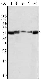 Monoclonal Mouse anti-Human LYN Antibody (clone 2H8D7, WB)