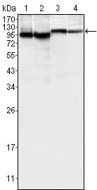 BTK Antibody (clone 7F12H4)
