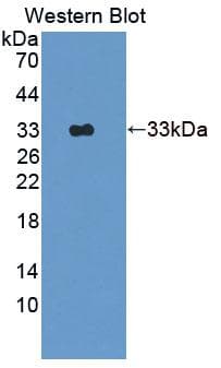 FOXP1 Antibody (aa461-671, Cy3)