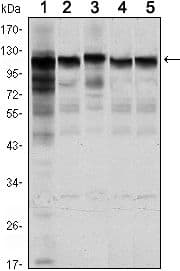 Monoclonal Mouse anti-Human HK1 / Hexokinase 1 Antibody (clone 7A7, IHC, IF, WB)
