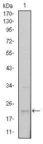 SNAI1 / SNAIL-1 Antibody (clone 6D2)