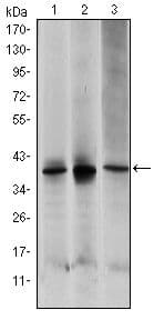 MAP2K6 / MEK6 / MKK6 Antibody (clone 3H12C8)