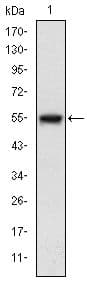 Monoclonal Mouse anti-Human MAP3K5 / ASK1 Antibody (clone 20000, IHC, IF, WB)