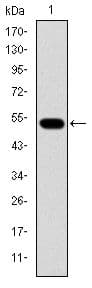 Monoclonal Mouse anti-Human GCK / Glucokinase Antibody (clone 4G6, WB)