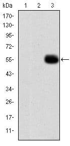 MMP9 / Gelatinase B Antibody (clone 5C3)