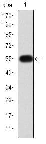 MMP9 / Gelatinase B Antibody (clone 5C3)