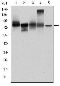 Monoclonal Mouse anti-Human JUP/CTNNG/Junction Plakoglobin Antibody (clone 4C12, IHC, IF, WB)