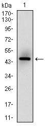 MSH6 Antibody (clone 5B11)
