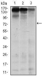 MSH6 Antibody (clone 5B11)