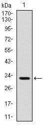 Monoclonal Mouse anti-Human CD30 Antibody (clone 3B10, WB)
