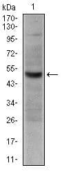 Monoclonal Mouse anti-Human CD30 Antibody (clone 3B10, WB)