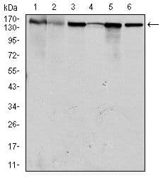 Monoclonal Mouse anti-Human MSH6 Antibody (clone 30, IHC, IF, WB)
