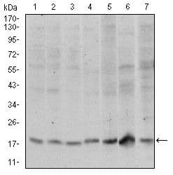 Monoclonal Mouse anti-Human SKP1 Antibody (clone 1H9, IHC, WB)