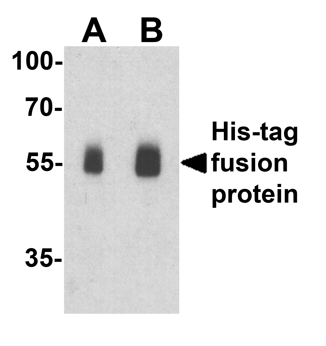 His Tag Antibody
