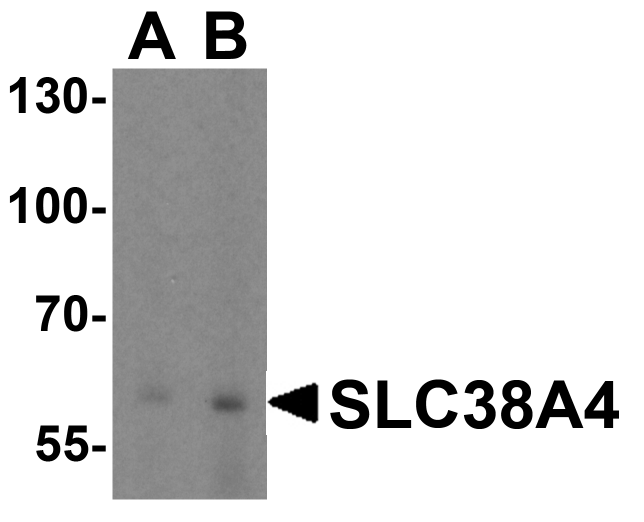 SLC38A4 / SNAT4 Antibody