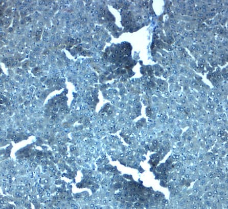 SLC38A4 / SNAT4 Antibody