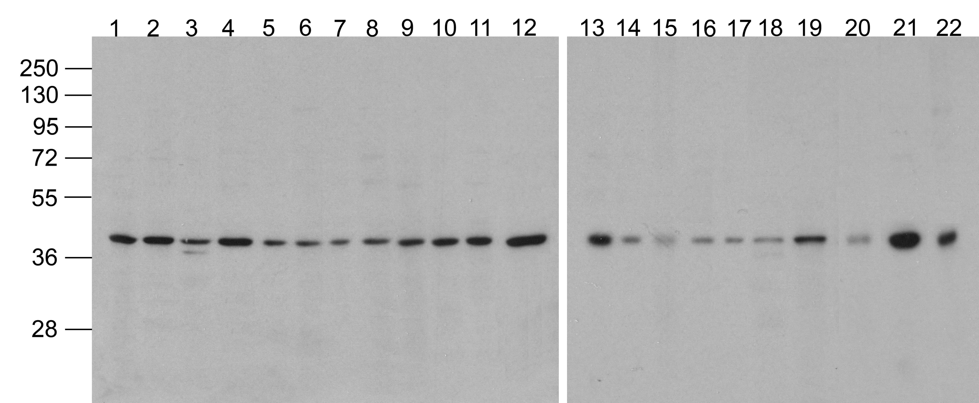 ACTB / Beta Actin Antibody (Biotin)
