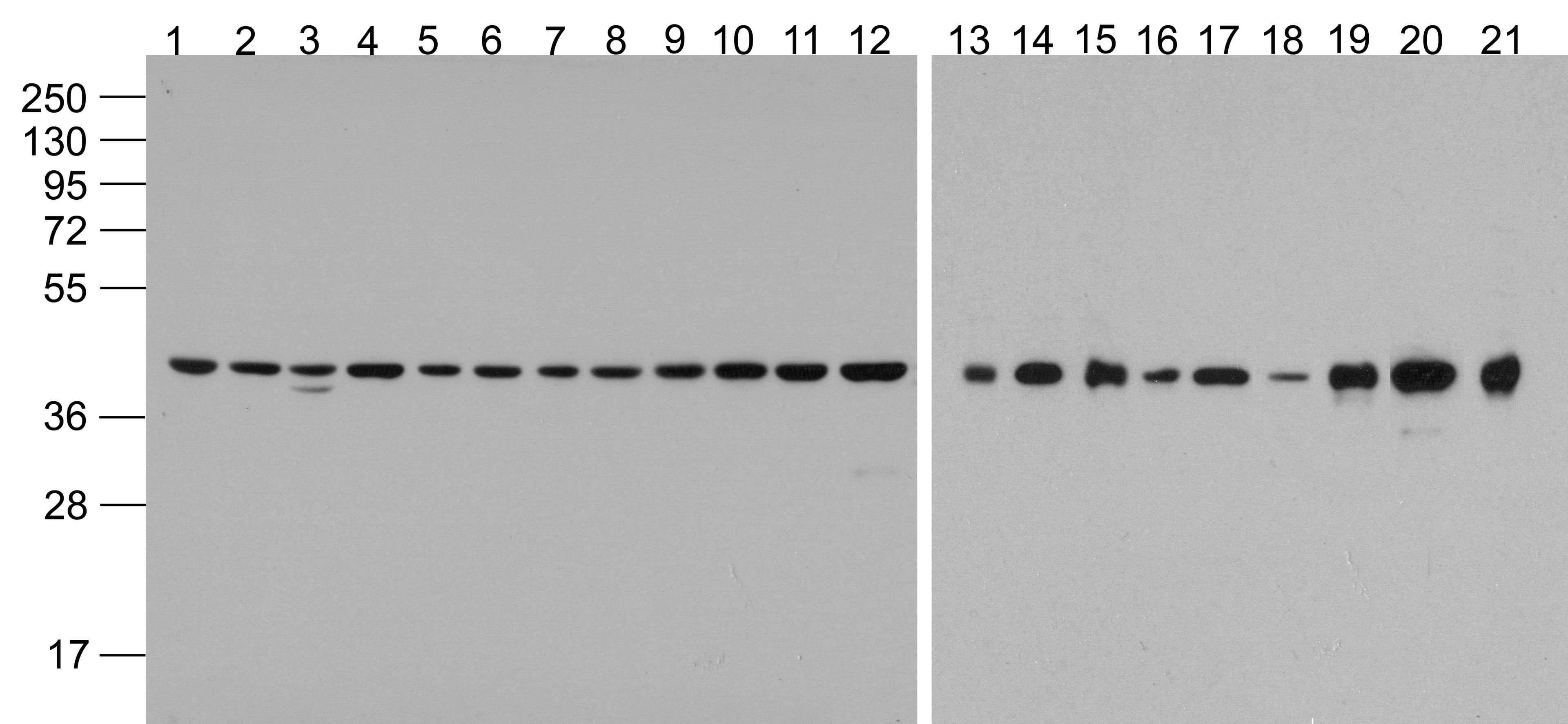 Polyclonal Rabbit anti-Human ACTB / Beta Actin Antibody (HRP, WB)