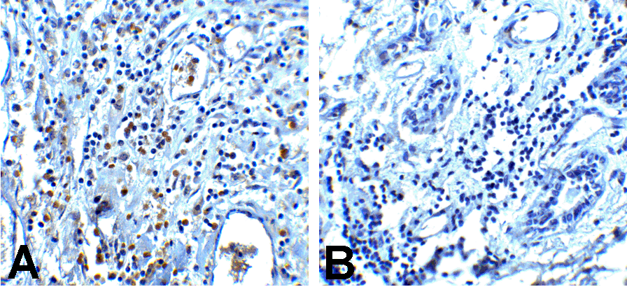PDCD1 / CD279 / PD-1 Antibody (clone 7H6)