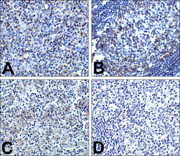 PDCD1 / CD279 / PD-1 Antibody (clone 7H6)