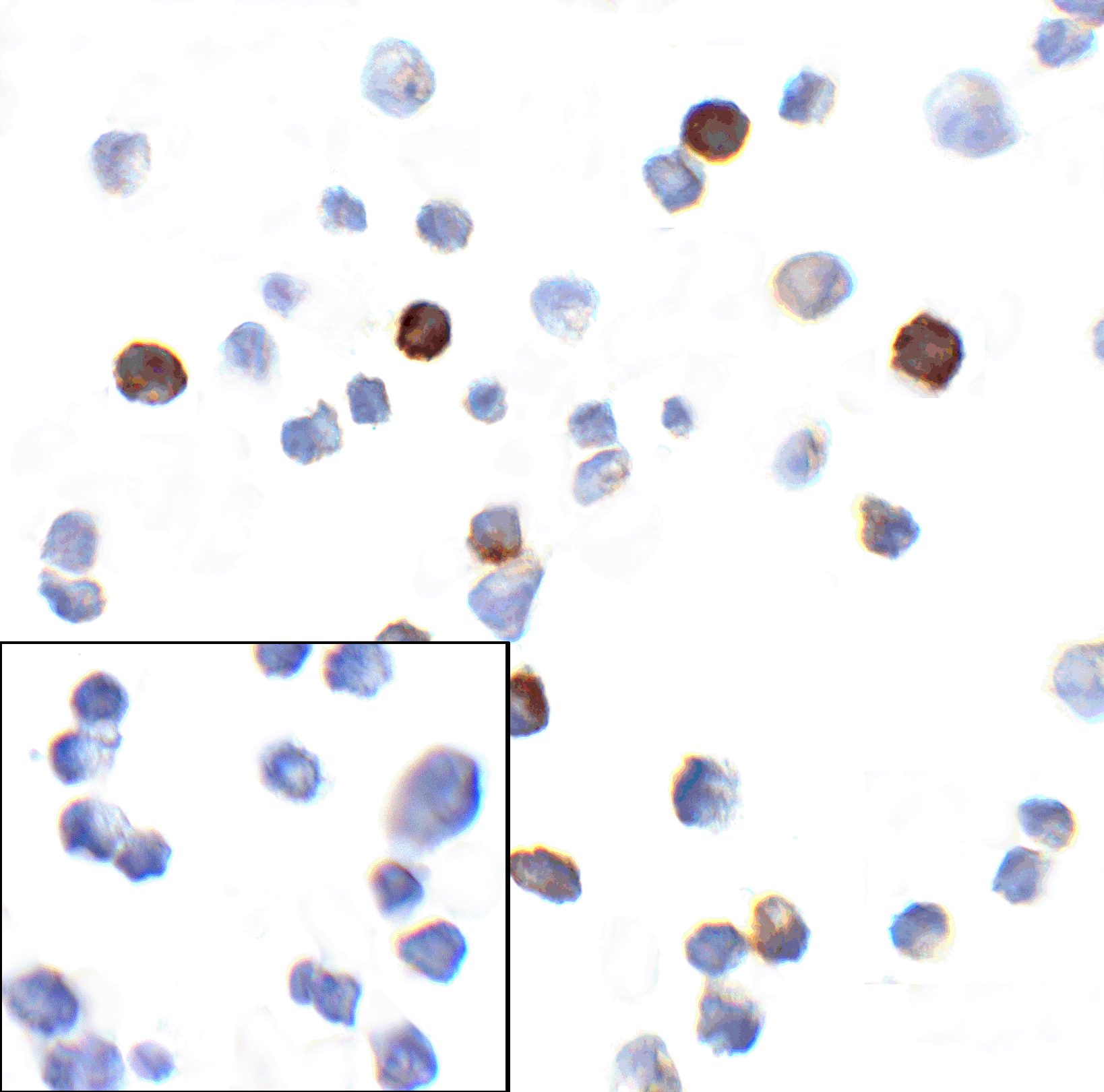 Monoclonal Mouse anti-Human PDCD1 / CD279 / PD-1 Antibody (clone 4C7, IHC, IF, WB)