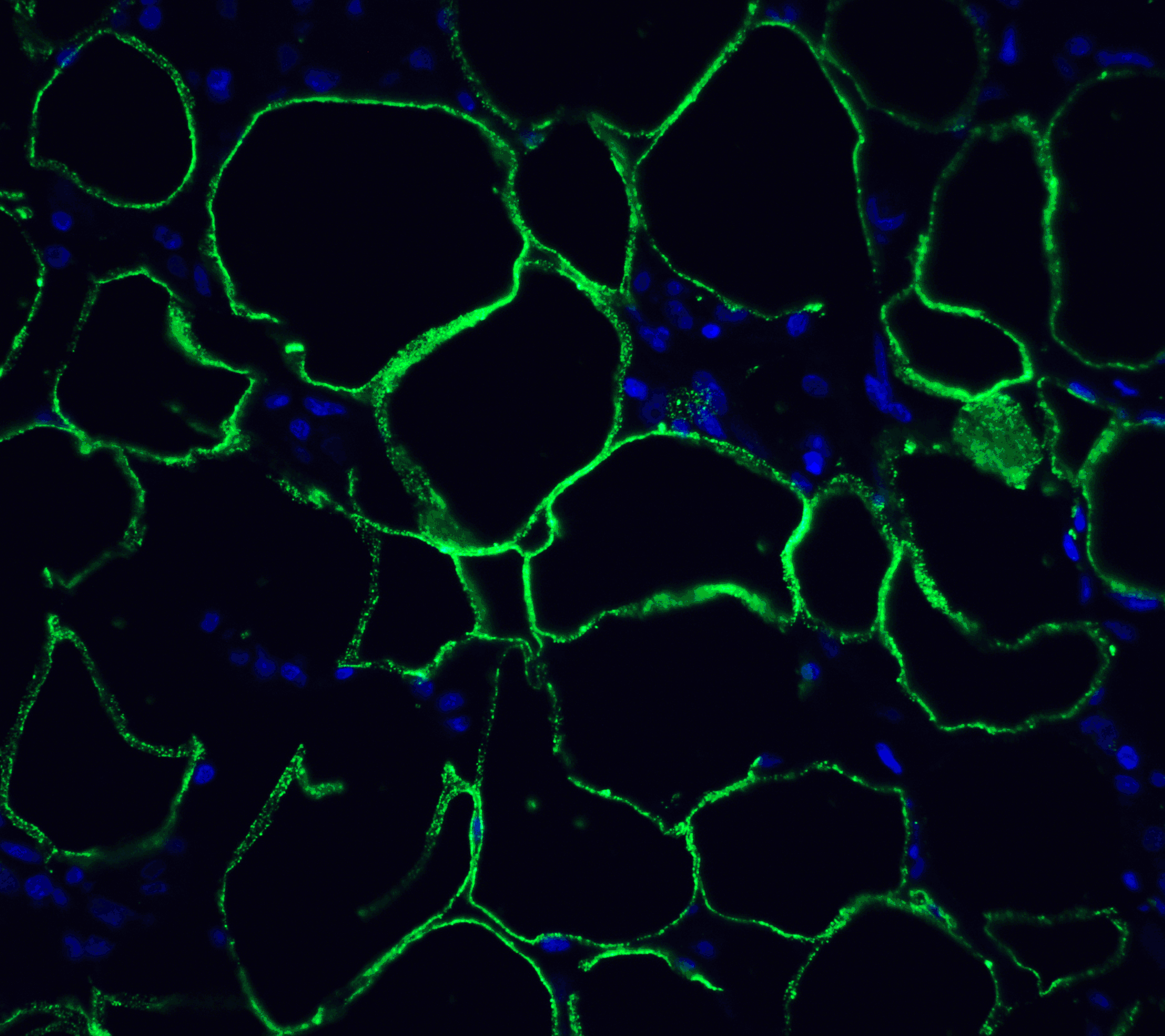 Monoclonal Mouse anti-Human PDCD1 / CD279 / PD-1 Antibody (clone 4C7, IHC, IF, WB)