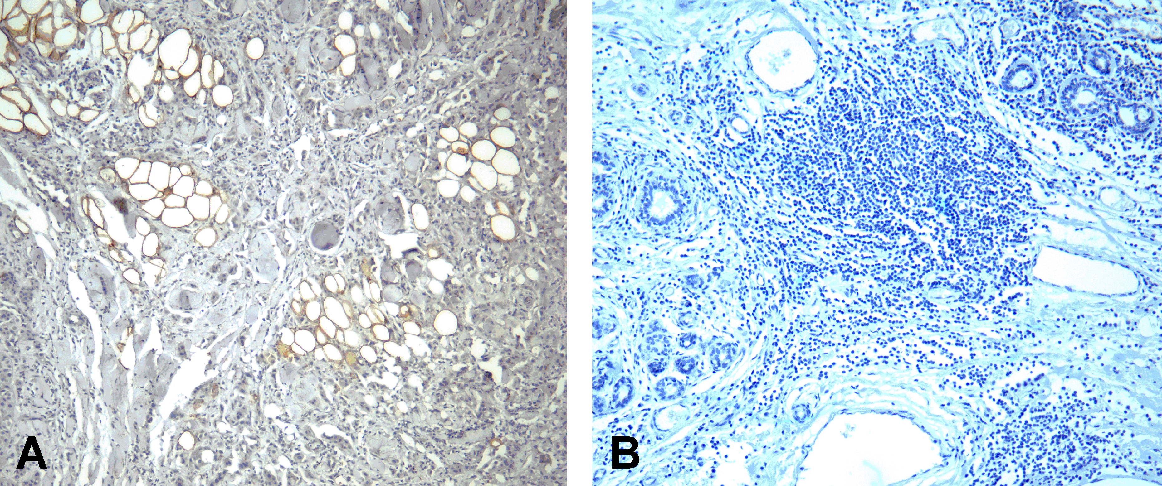 Monoclonal Mouse anti-Human PDCD1 / CD279 / PD-1 Antibody (clone 4C7, IHC, IF, WB)