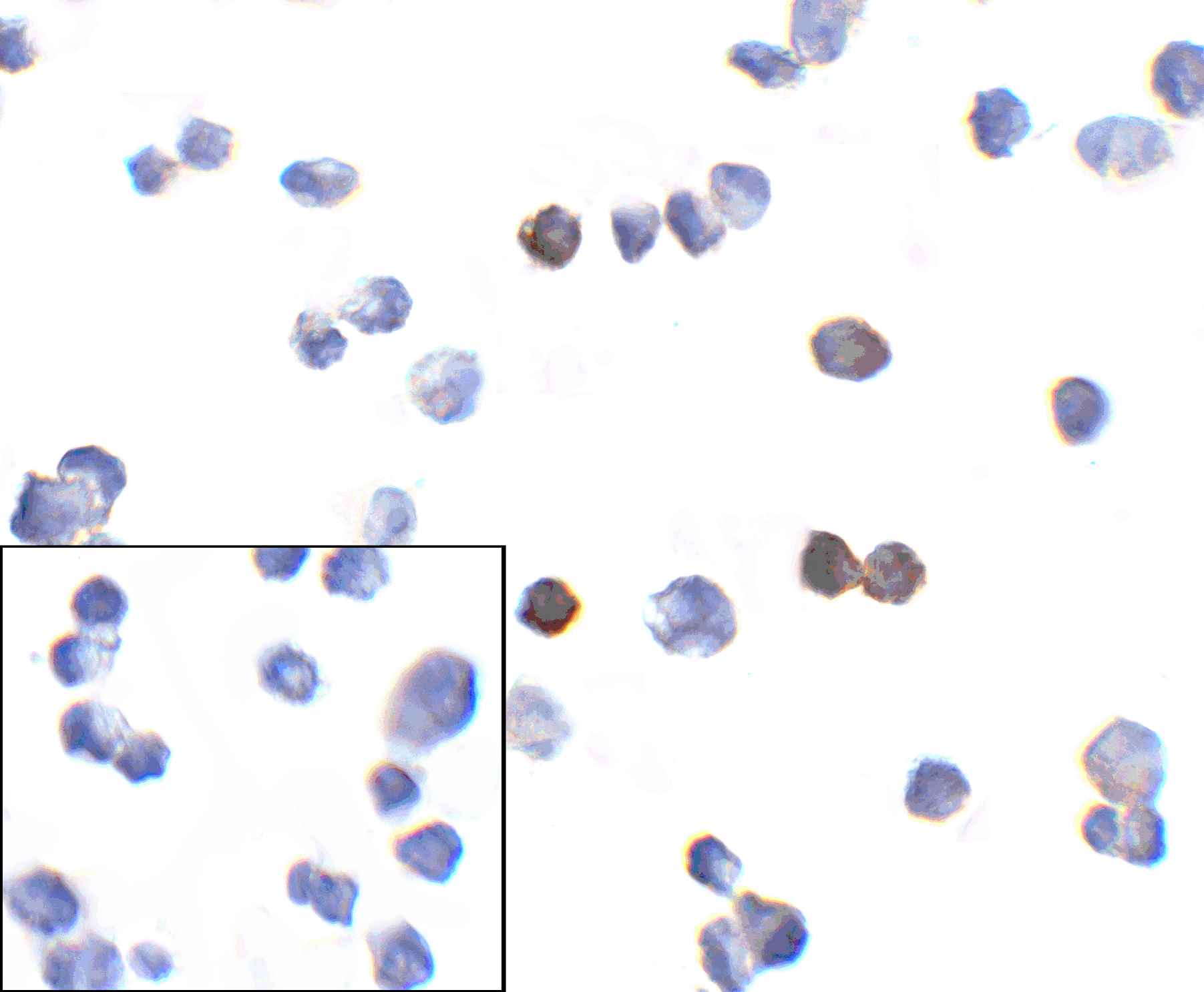 PDCD1 / CD279 / PD-1 Antibody (clone 10B3)