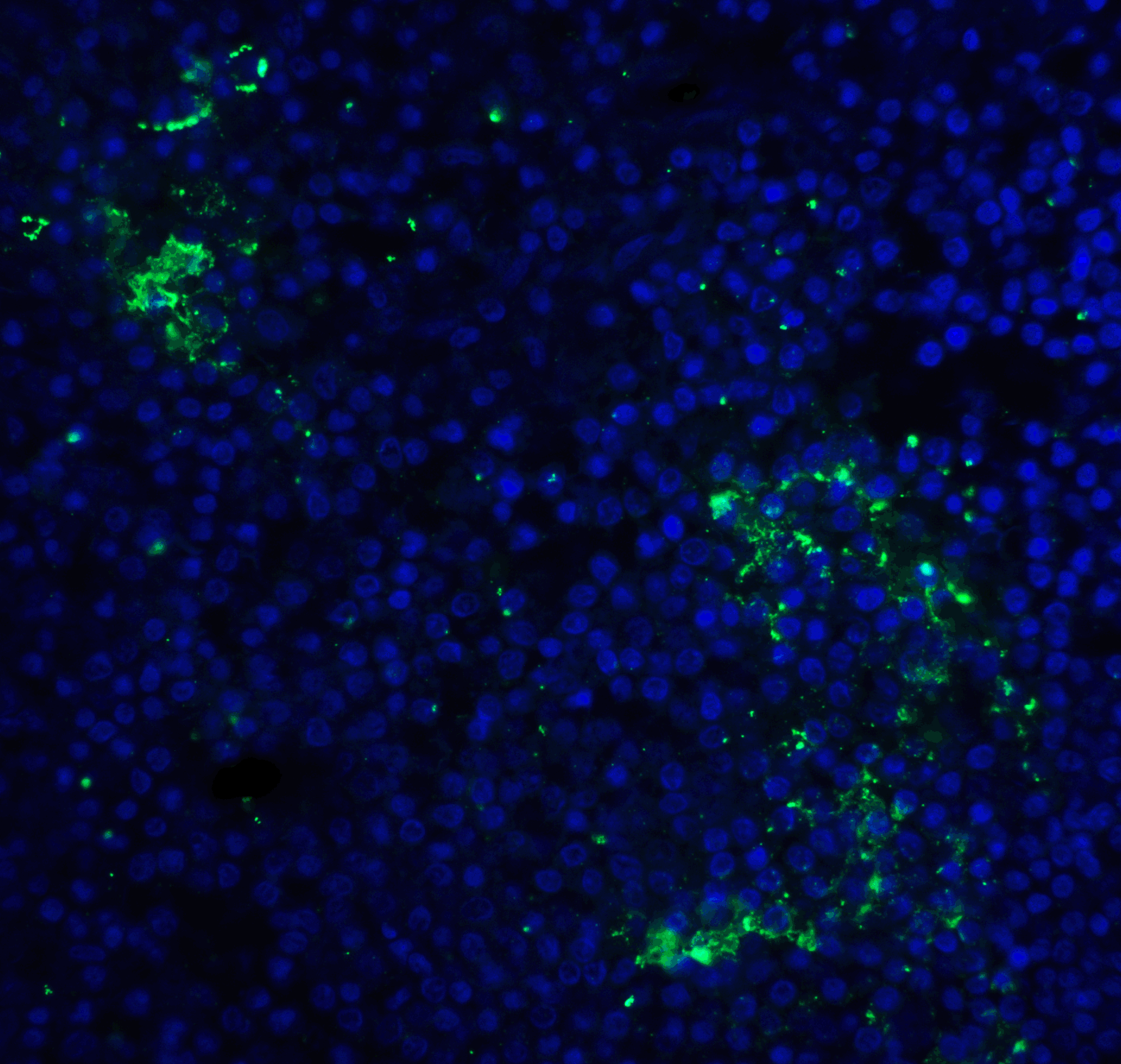 PDCD1 / CD279 / PD-1 Antibody (clone 10B3)