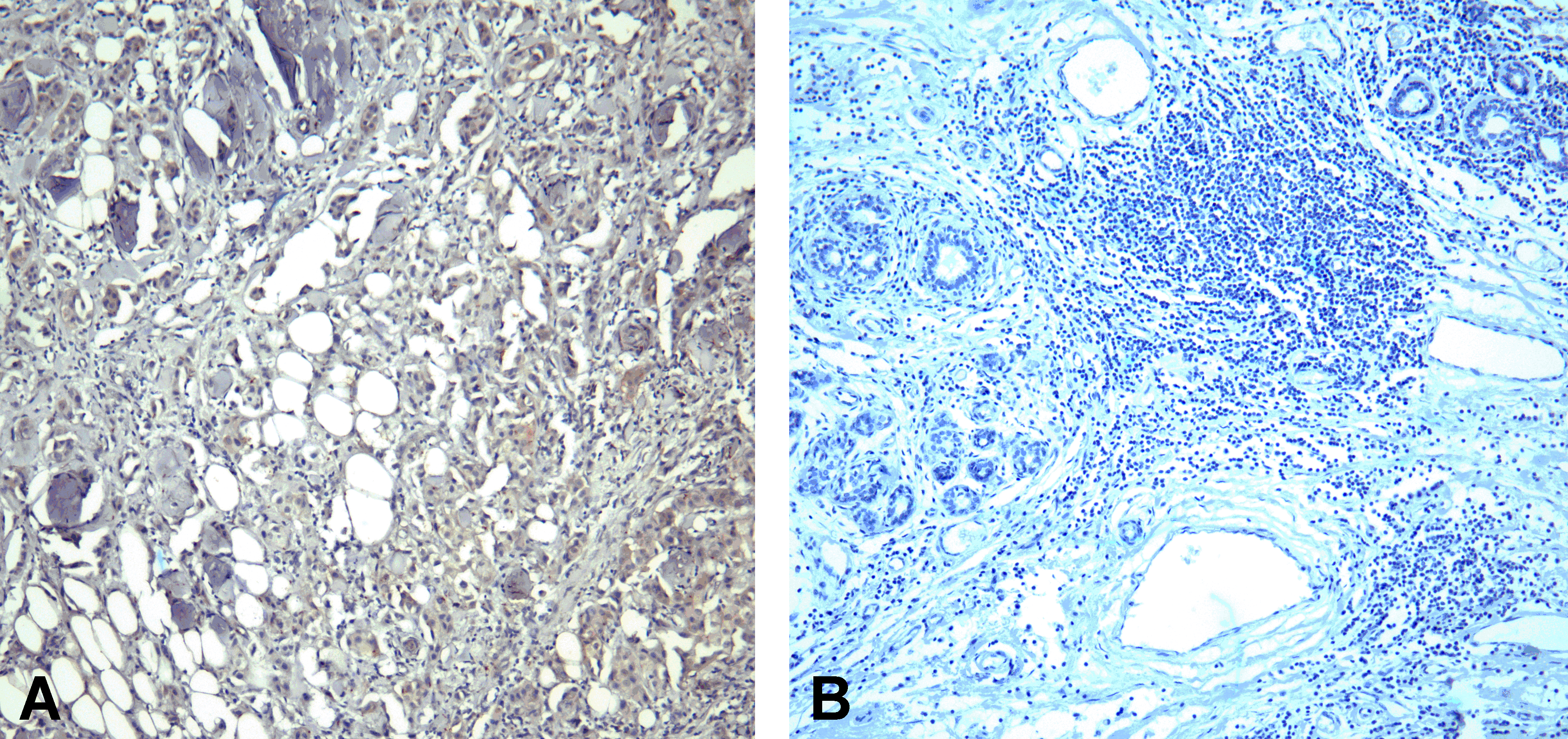 PDCD1 / CD279 / PD-1 Antibody (clone 10B3)