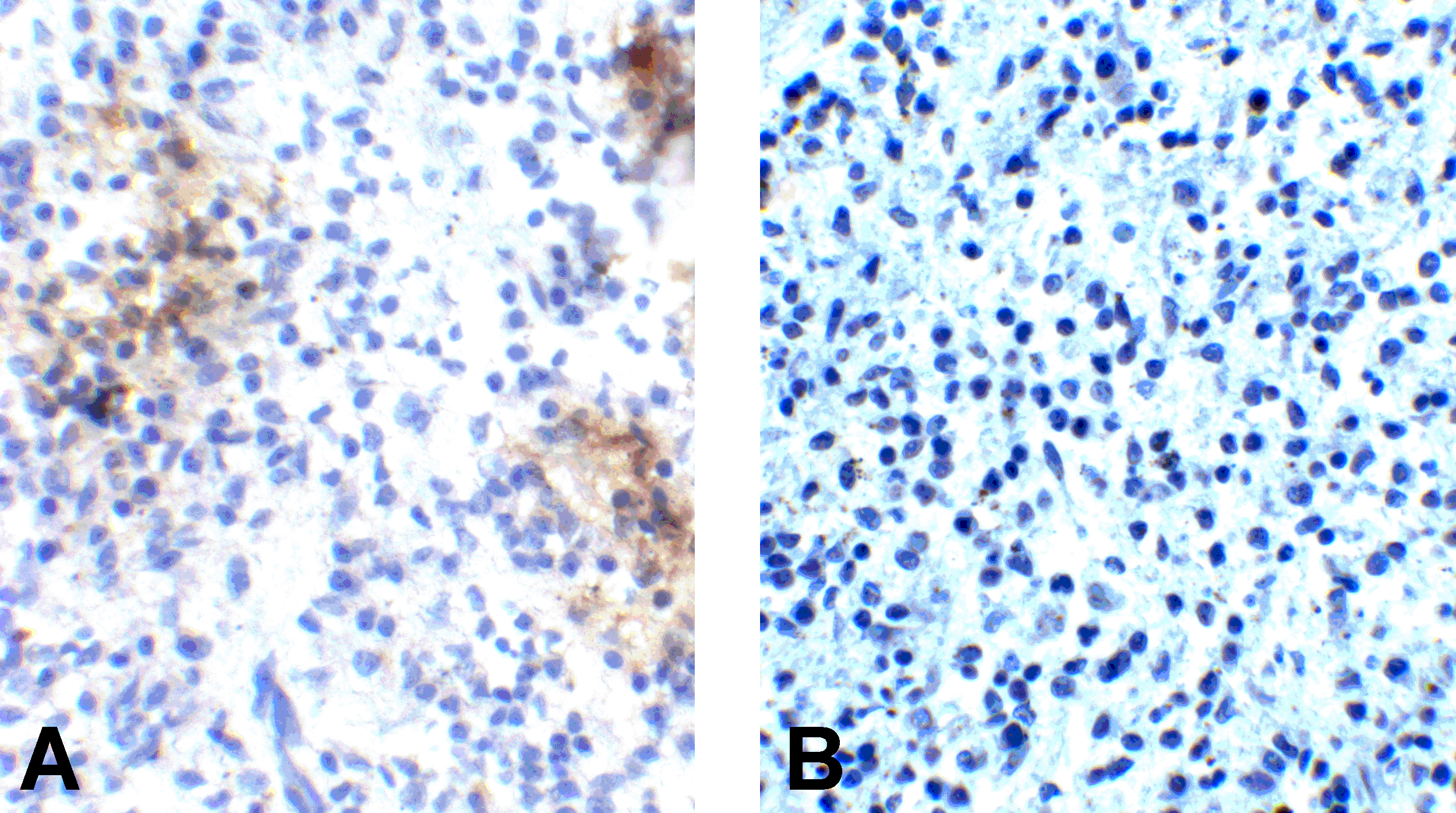 PDCD1 / CD279 / PD-1 Antibody (clone 10B3)