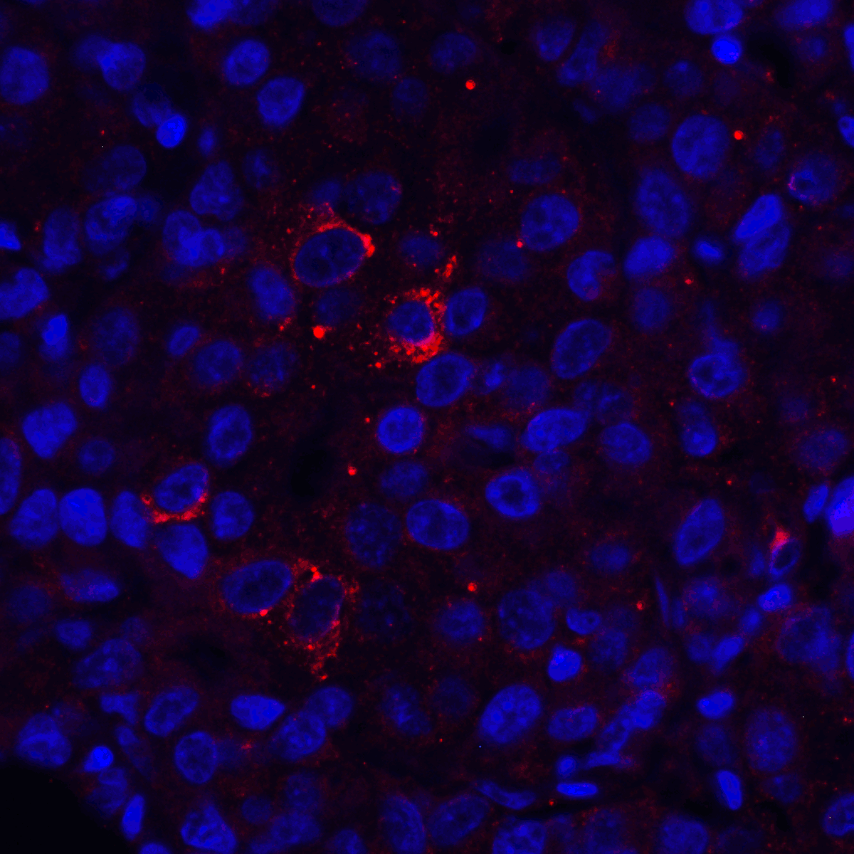 Monoclonal Mouse anti-Human VSIR / GI24 / VISTA Antibody (clone 9E4, IHC, IF)