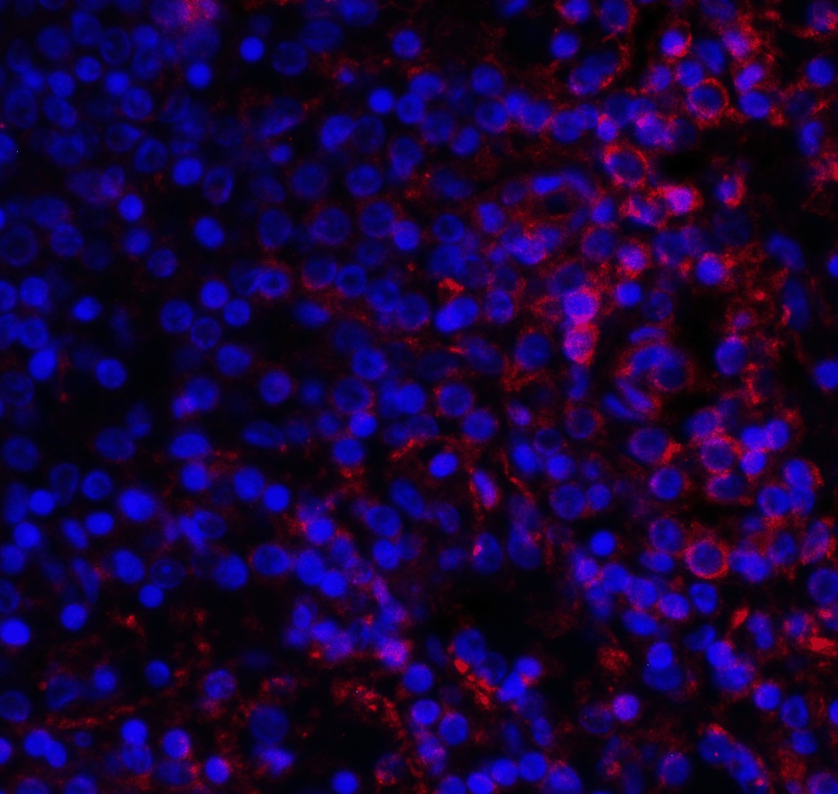 Monoclonal Mouse anti-Human VSIR / GI24 / VISTA Antibody (clone 9E4, IHC, IF)