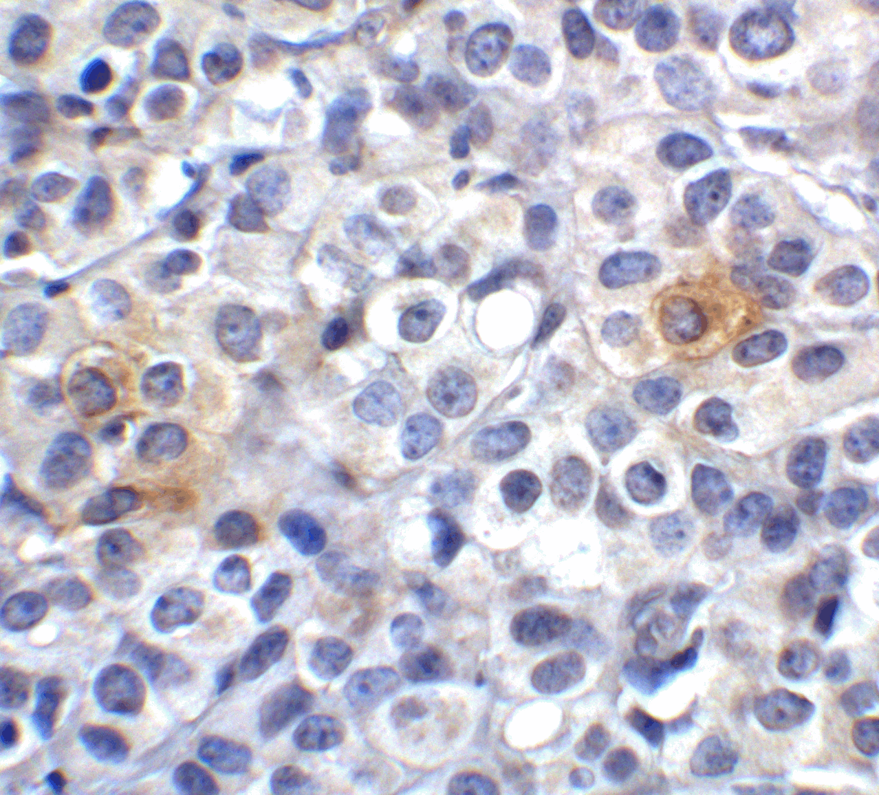 Monoclonal Mouse anti-Human VSIR / GI24 / VISTA Antibody (clone 9E4, IHC, IF)