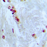 ZNF287 Antibody