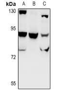 CHSY1 Antibody