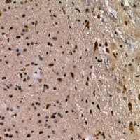 FKBPL Antibody