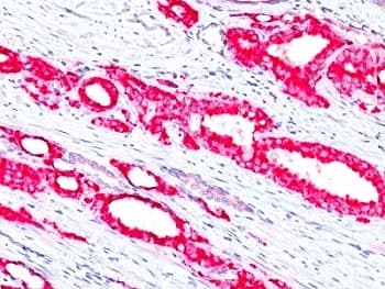 AMACR / P504S Antibody (clone 13H4)