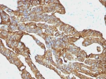 Monoclonal Mouse anti-Human EPCAM Antibody (clone EGP40/1372, IHC, IF, WB)