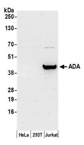 Polyclonal Rabbit anti-Human ADA / Adenosine Deaminase Antibody (aa1-50, WB)
