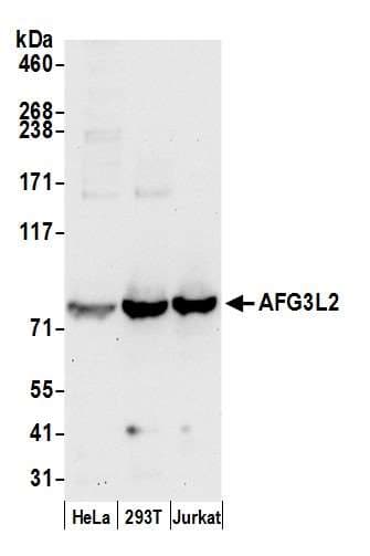 Polyclonal Rabbit anti-Human AFG3L2 Antibody (aa75-125, WB)