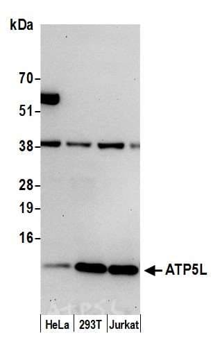 Polyclonal Rabbit anti-Human ATPase Subunit G / ATP5L Antibody (aa53-103, WB)