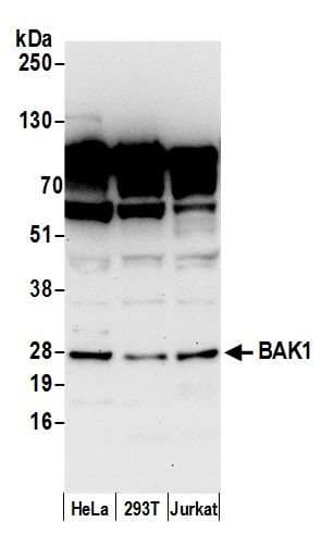 Polyclonal Rabbit anti-Human BAK1 / BAK Antibody (aa50-100, WB)